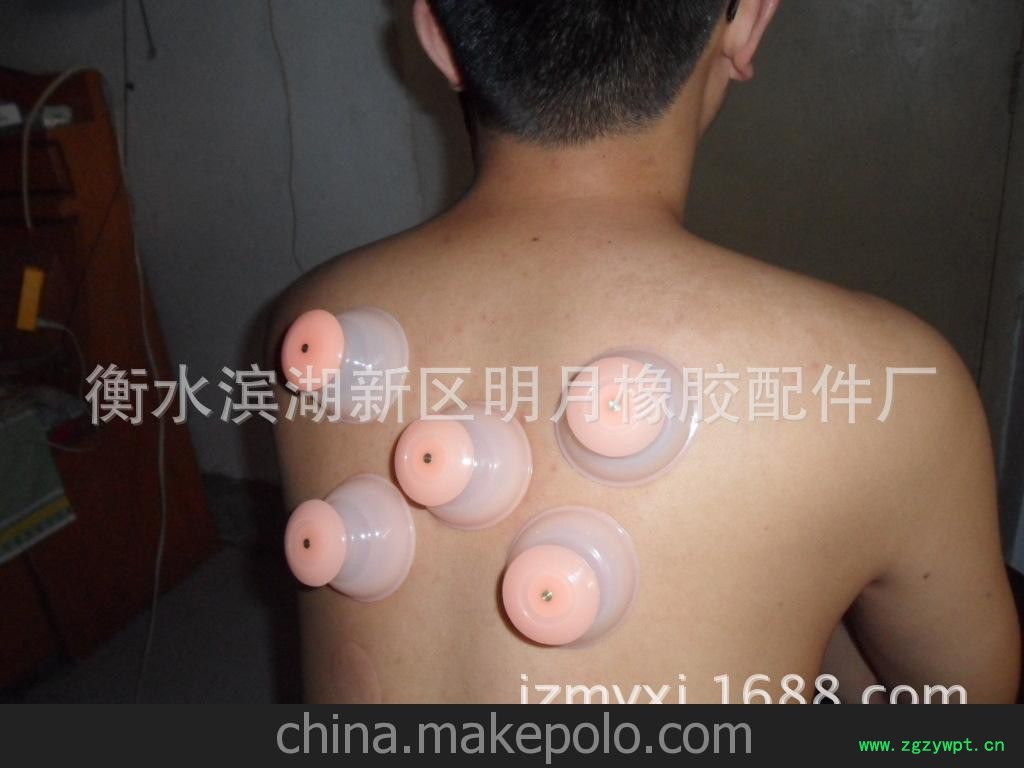 简易自粘无毒粉色硅胶橡胶火罐吸湿器吸力强真空随身 韩国人气图2