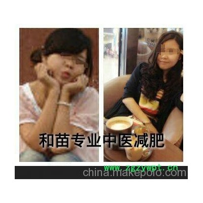 江北和苗提供最新重庆中医针灸埋线减肥